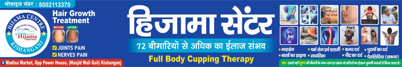 Hijama Centre Kishanganj