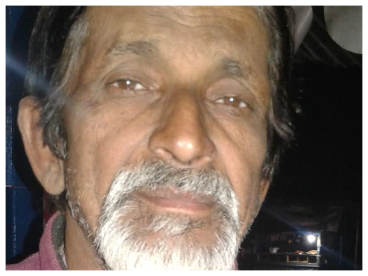  पेड़ से टकराई कार, बुजुर्ग की मौत और 5 लोग गंभीर रूप से घायल