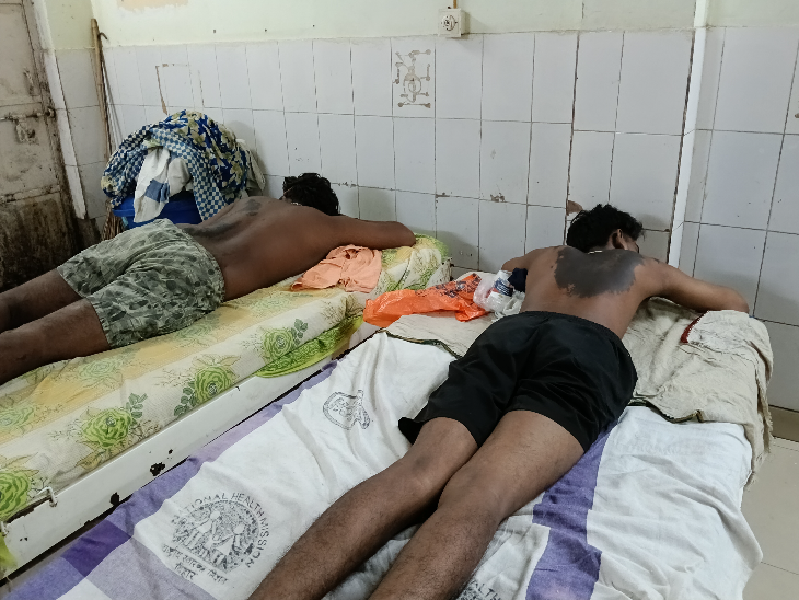 पूर्णिया में जातीय तनाव का खौफनाक अंजाम, 5 पर एसिड अटैक